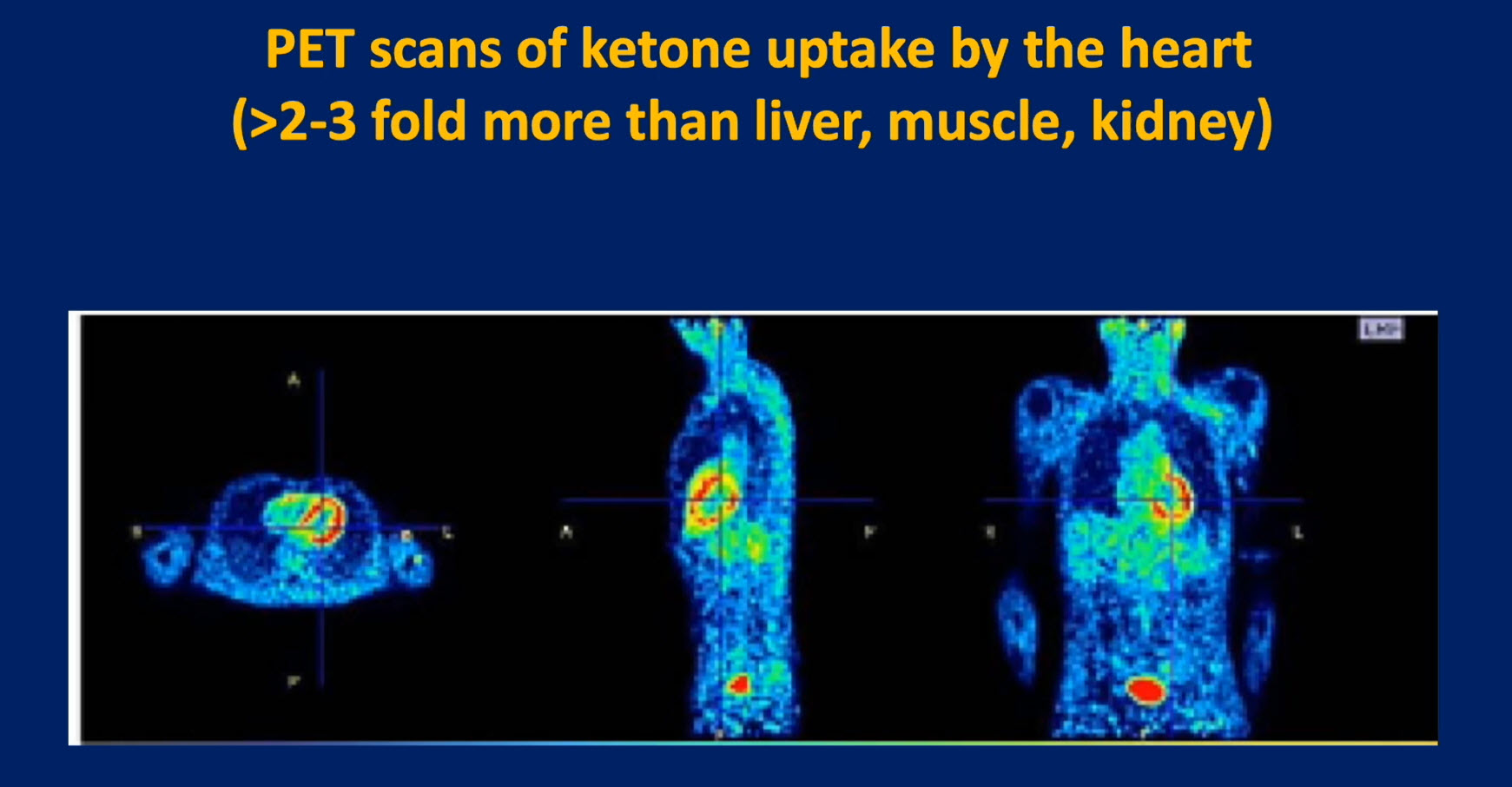 organ scan ketones