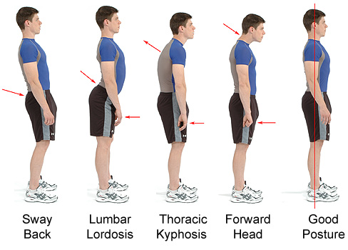 posture diagram posture diagram