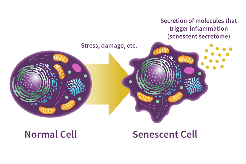 senescent cell